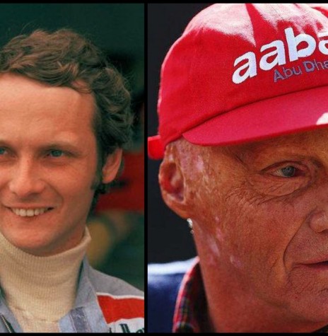 || Piloto austríaco Niki Lauda morto em maio de 2019, em imagens  antes e depois do acidente com o rosto transformado por causa das queimaduras e cirurgias plásticas. 
Imagem: NY Times - FOTO 27 - 
