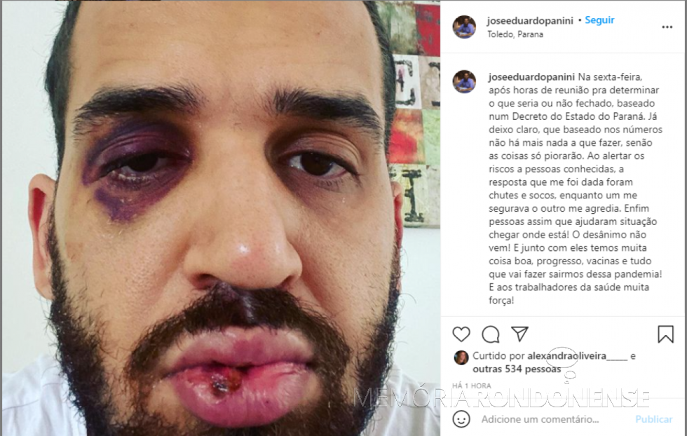 || Médico infectologista toledano José Eduardo Mainart Panini agredido em final de fevereiro de 2021, por defender as medidas do Governo do Paraná para o enfrentamento da COVID 19, em fevereiro de 2021.
Imagem: Acervo O Presente - FOTO 17 -